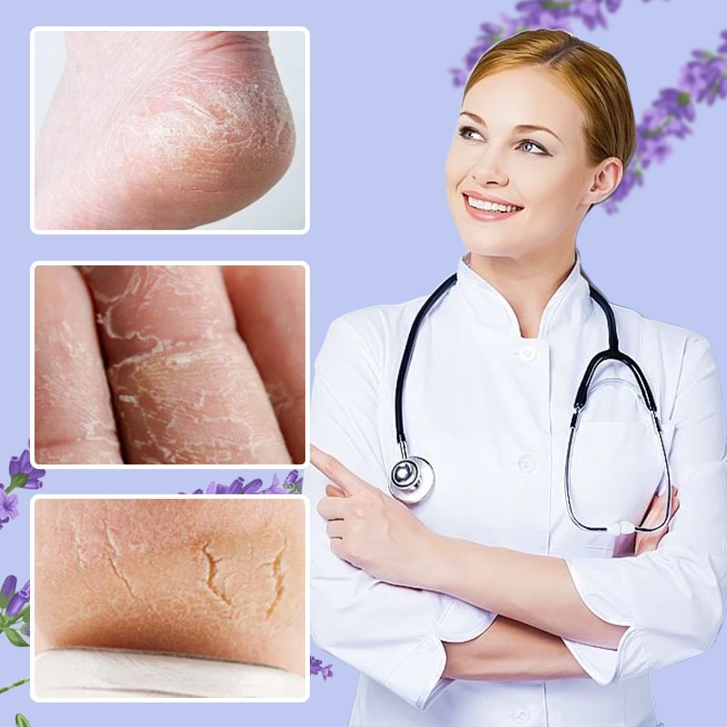 🔥Nourishing and repairing dry and cracked skin Look 20 years❤️ younger in an instant Limited time 77% off Come and give your feet a fresh new look!