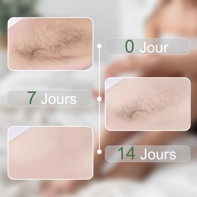 🌈250g gentle hair removal cream for men and women, suitable for multiple body parts💥