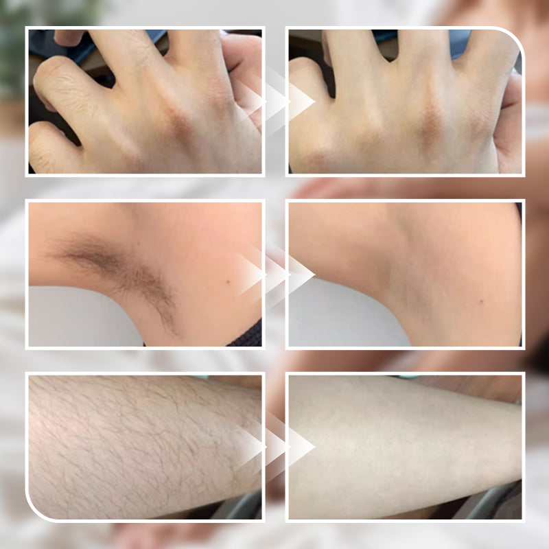 🌈250g gentle hair removal cream for men and women, suitable for multiple body parts💥