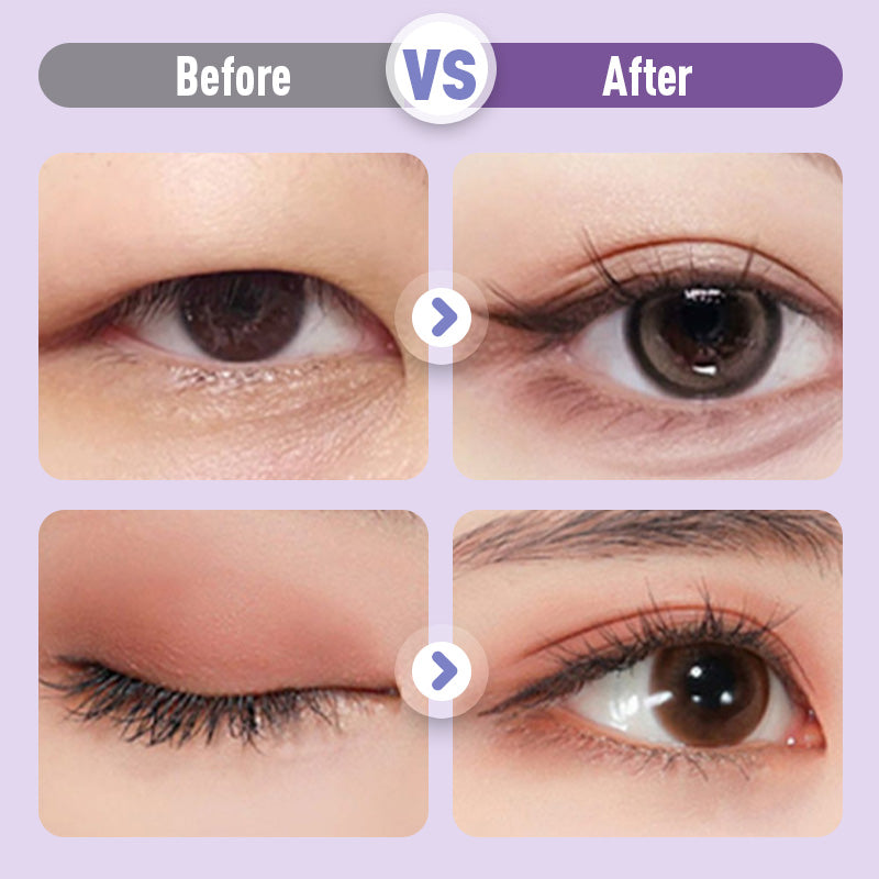 šLast Day Buy 1 Get 1 Freeā³Long Lasting & Invisible Double Eyelid Styling Cream