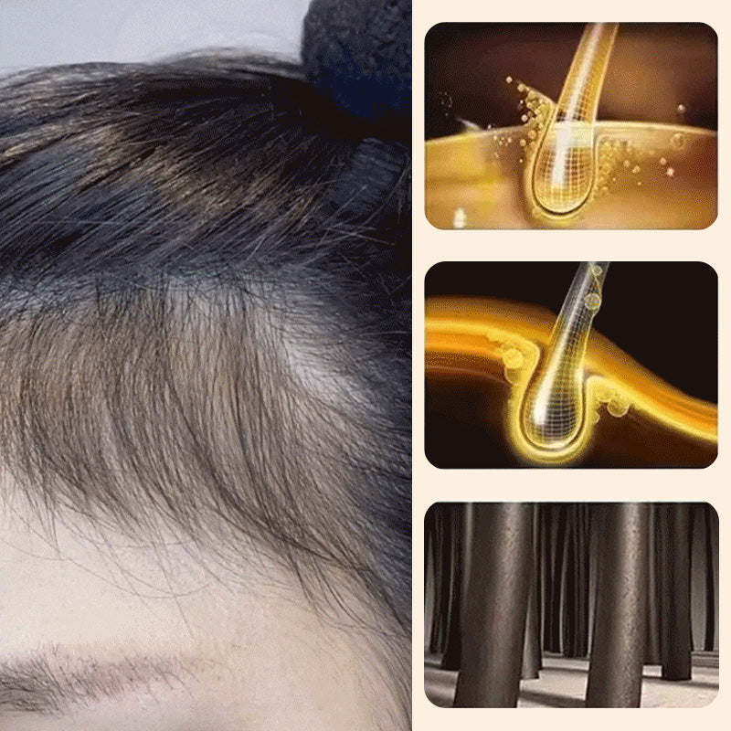 Polygonum Shampoo Soap, Cleansing Hair & Face