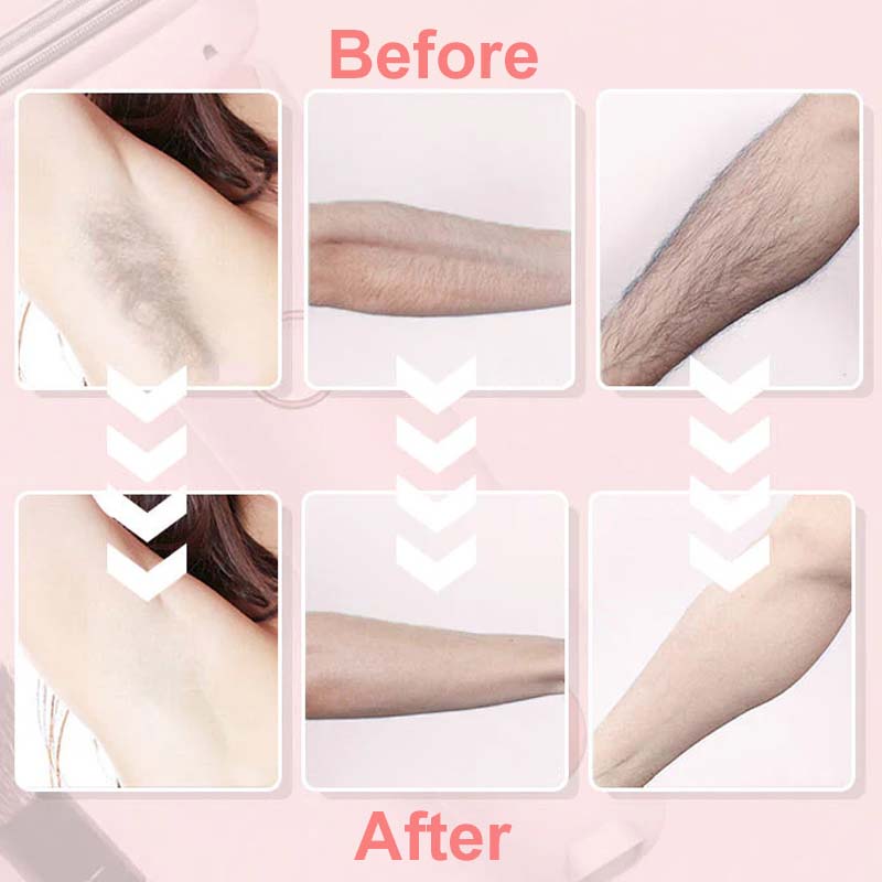 💖HOT SALE 49% OFF💖 Electric Body Hair Trimmer for Men & Women