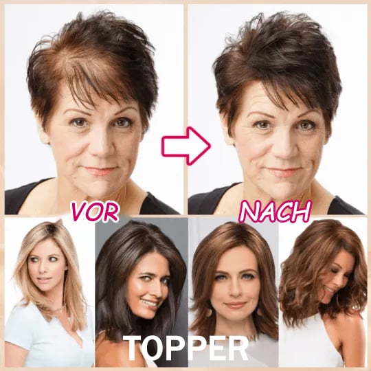 🔥Only $19.99 Last Day 💥Breathable Natural Hair Tips for Women with Thinning Hair