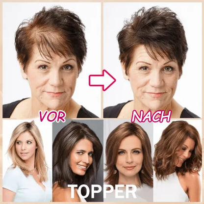 🔥Only $19.99 Last Day 💥Breathable Natural Hair Tips for Women with Thinning Hair
