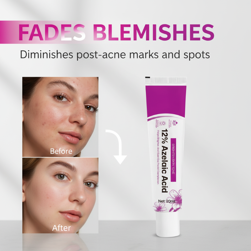 ⏰Black Friday Countdown! ⚡ 12% Azelaic Acid Acne Cream