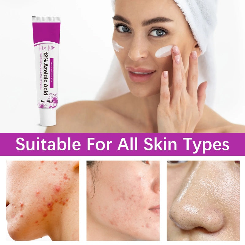 ⏰Black Friday Countdown! ⚡ 12% Azelaic Acid Acne Cream