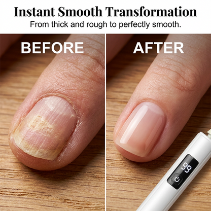 🥳2026 HOT SALE🥳💞50K+ SOLD!💅✨ 47% OFF! Professional Electric Nail Polisher – Smooths thick nails, 99-speed display. Multiple heads for shaping & buffing. Salon at home! 🌟💎
